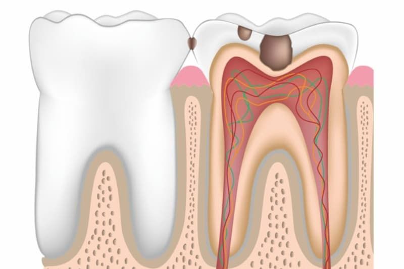 Первая помощь при зубной боли и других острых стоматологических состояниях