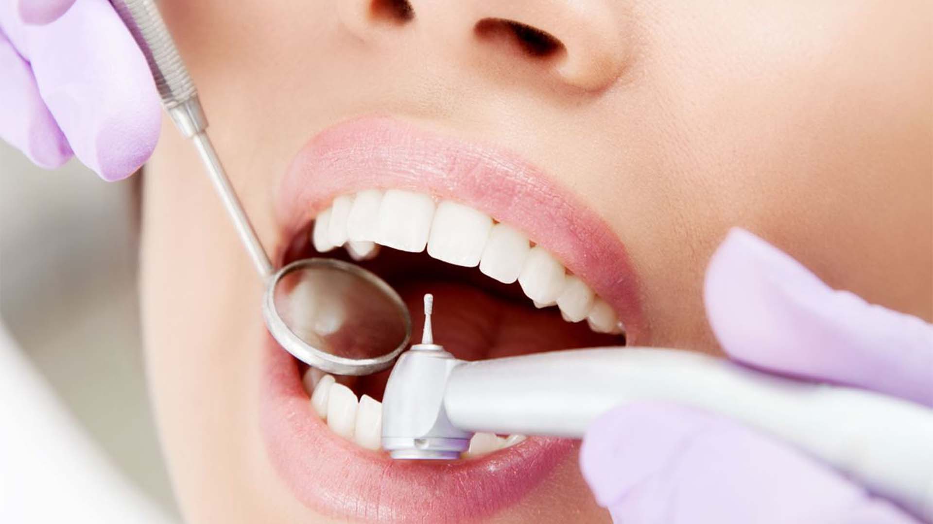 Сколько по времени лечат зуб с кариесом?