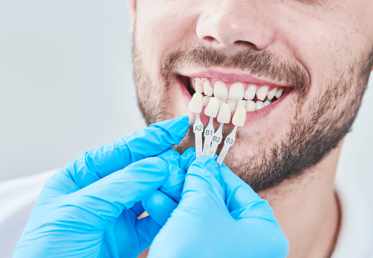 Особенности имплантации зубов за один день