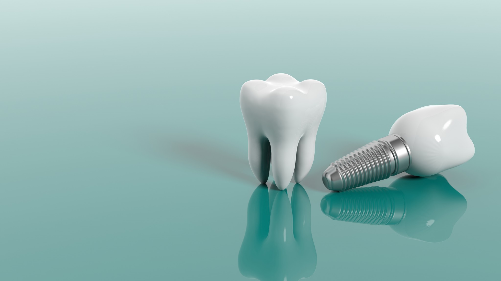 От чего зависит стоимость имплантации зуба под ключ