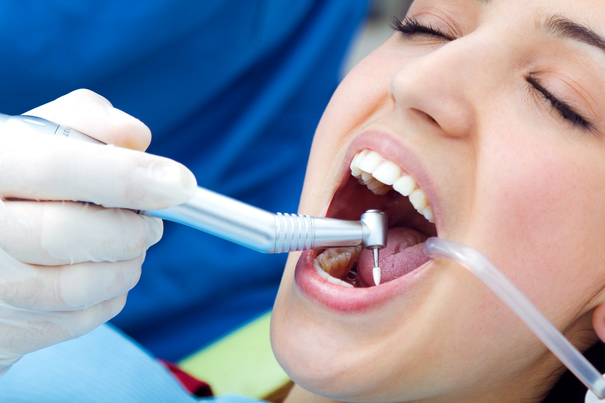 Сколько стоит лечение каналов зуба и как проводится?