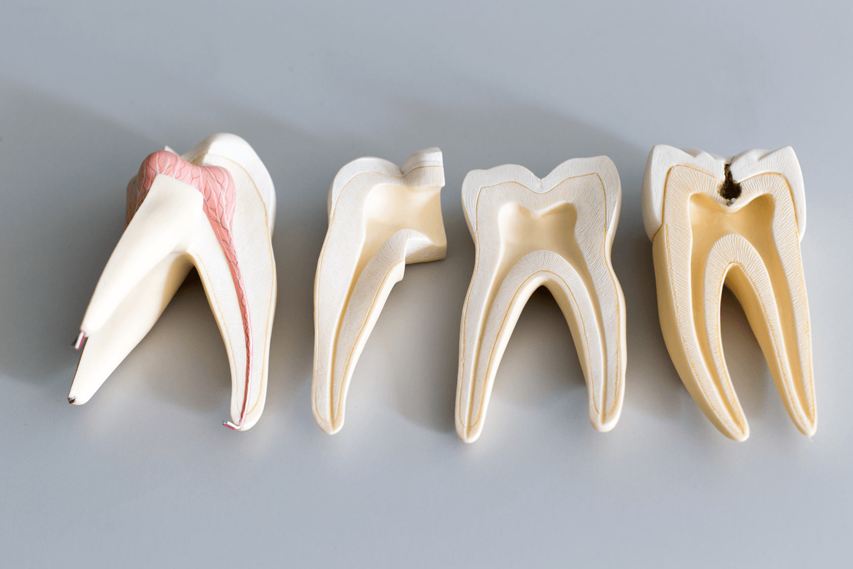 Этапы лечения корневых каналов временных зубов