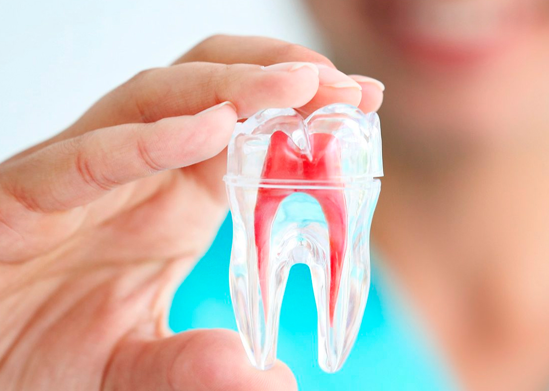 Этапы лечения корневых каналов временных зубов