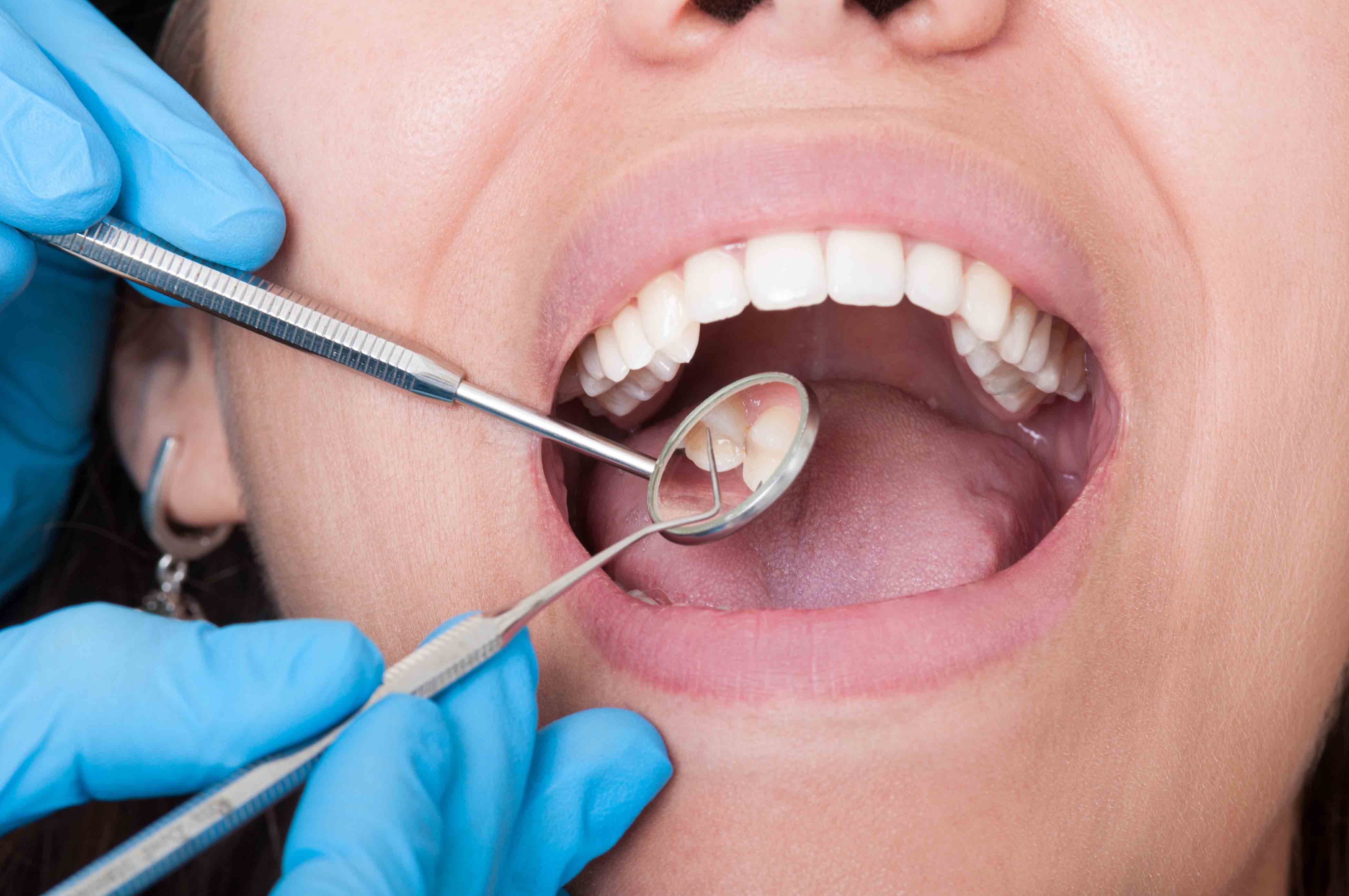 Лечение заболевшего зуба