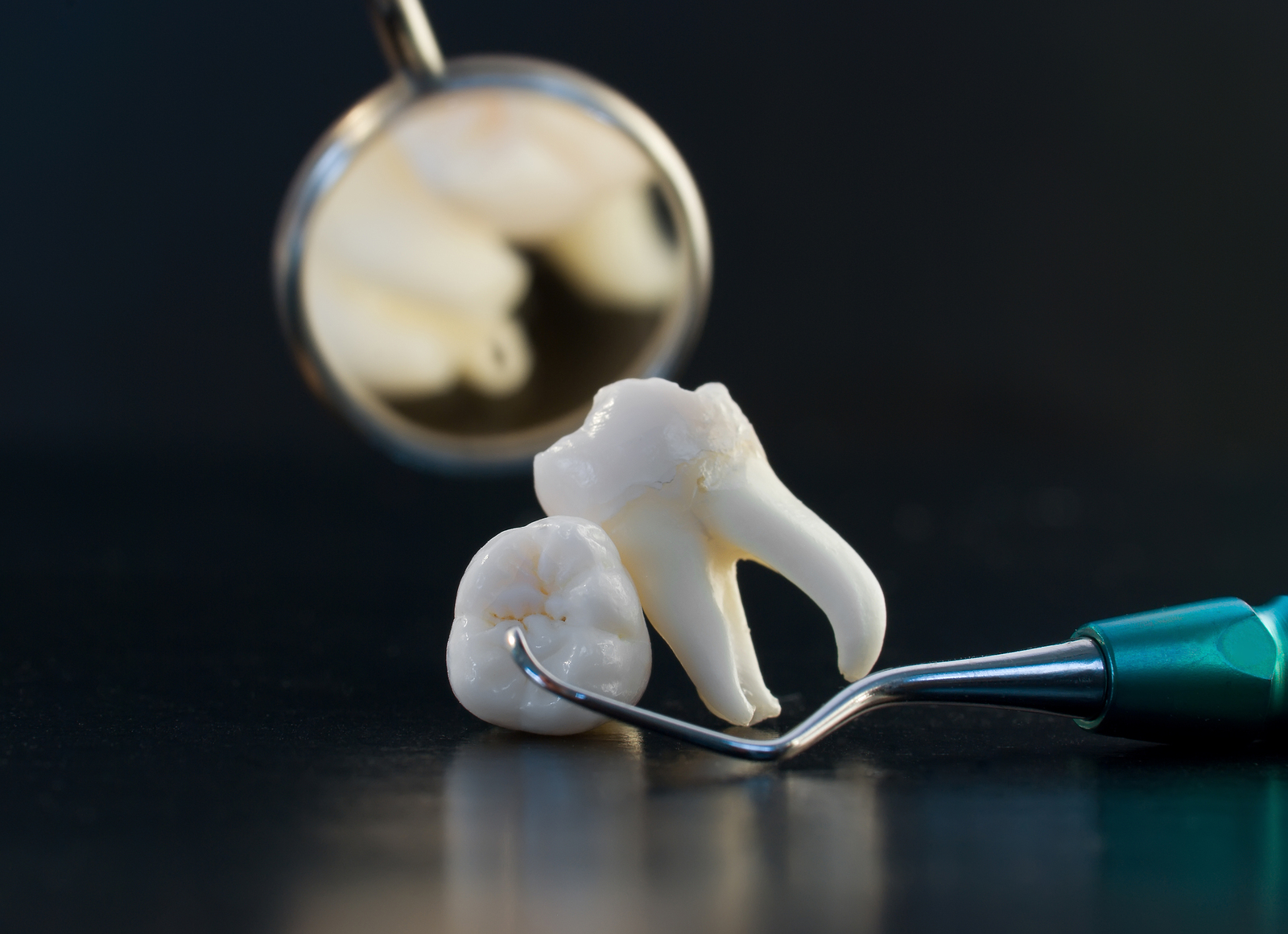 Когда назначают сложное удаление ретинированного или дистопированного зуба?
