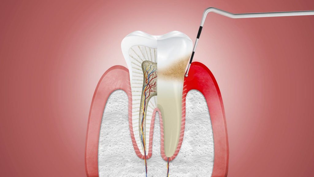 От чего зависят цены на лечение корневых каналов зубов
