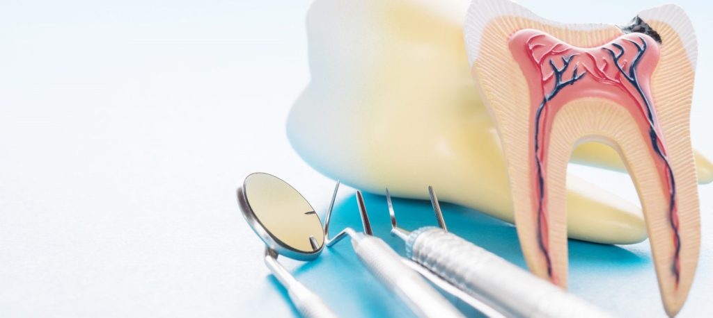 Современные методы лечения каналов корней зубов