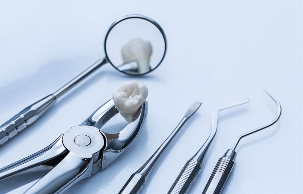 Удаление зуба мудрости под наркозом: основные этапы и сложности операции