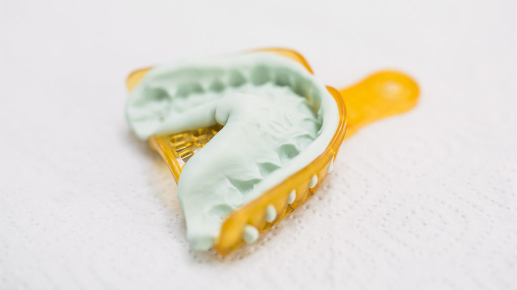 Материал для снятия слепков зубов: что используют современные стоматологи