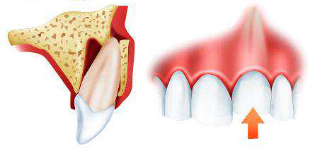 Диагностика травмы зубов