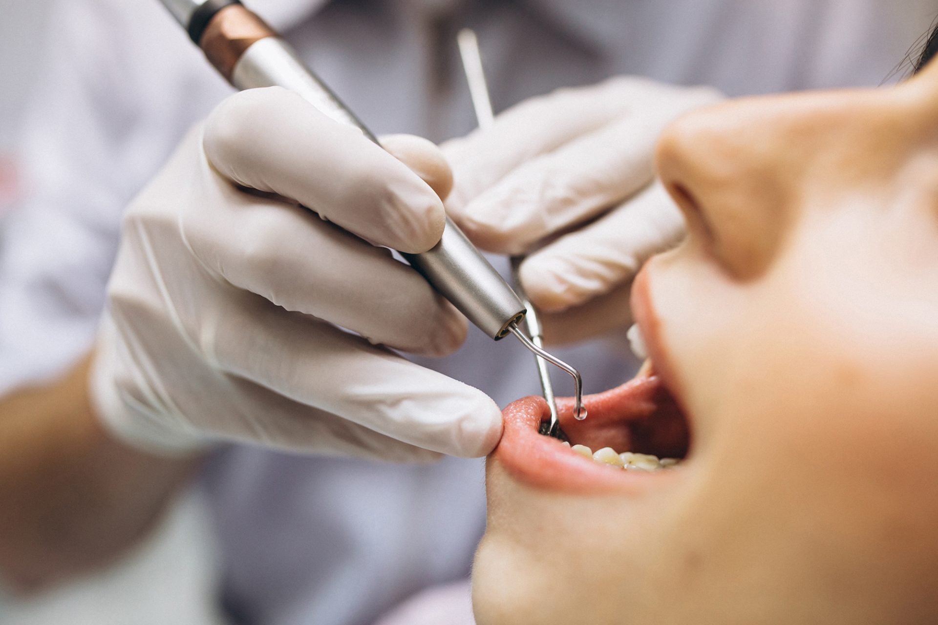 Лечение пульпита, если болит зуб: особенности воздействия