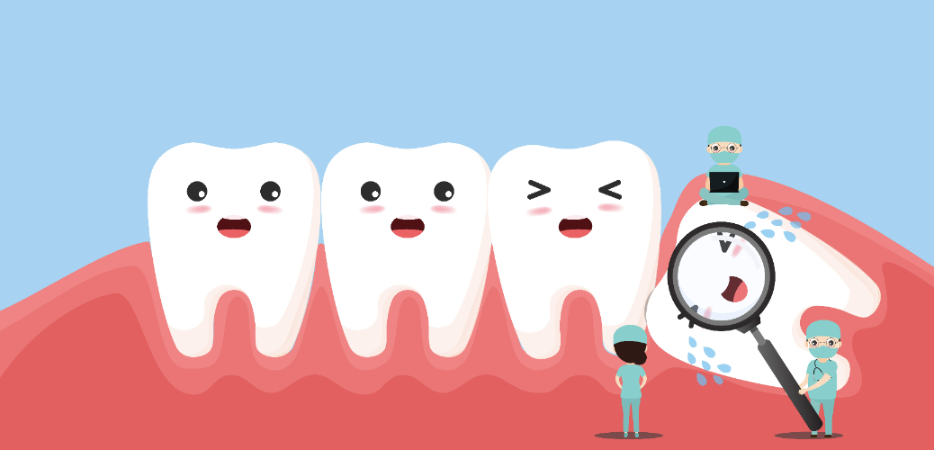 Зуб мудрости болит: удаление или лечением медикаментами