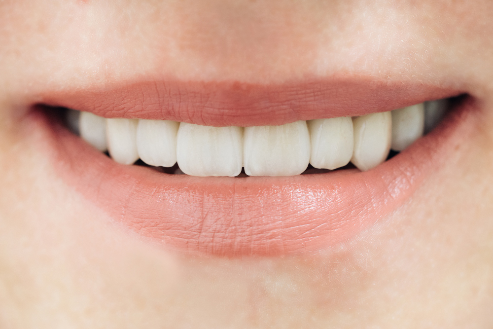 Особенности протезирования 4 передних зубов