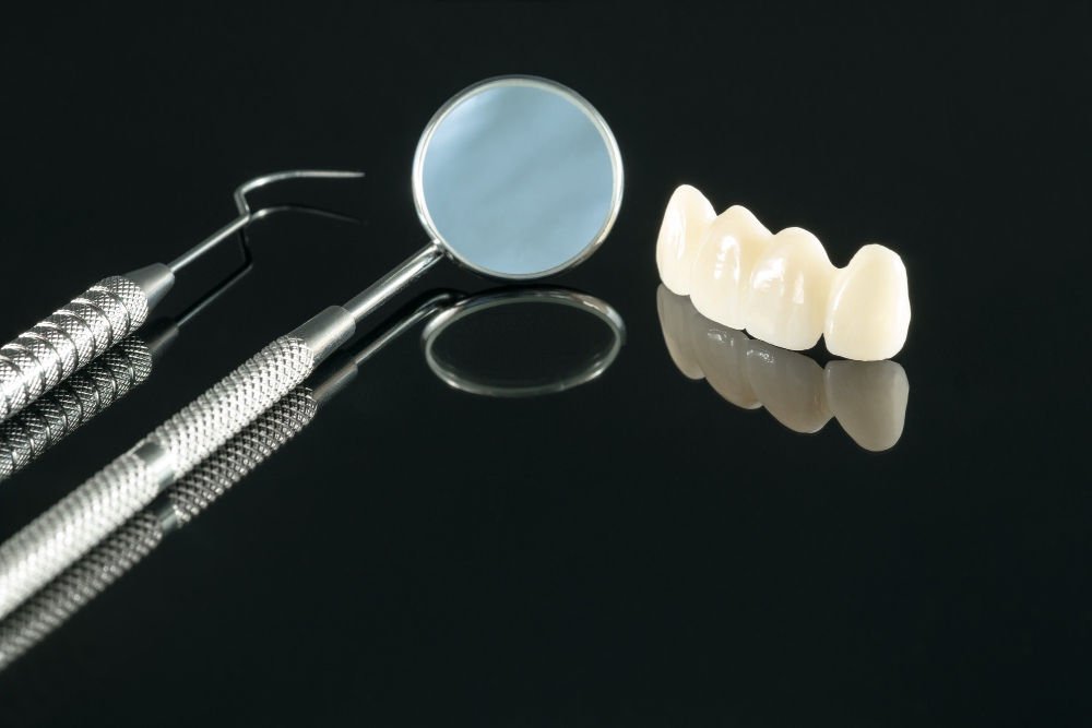 Виды протезирования 4 верхних зубов