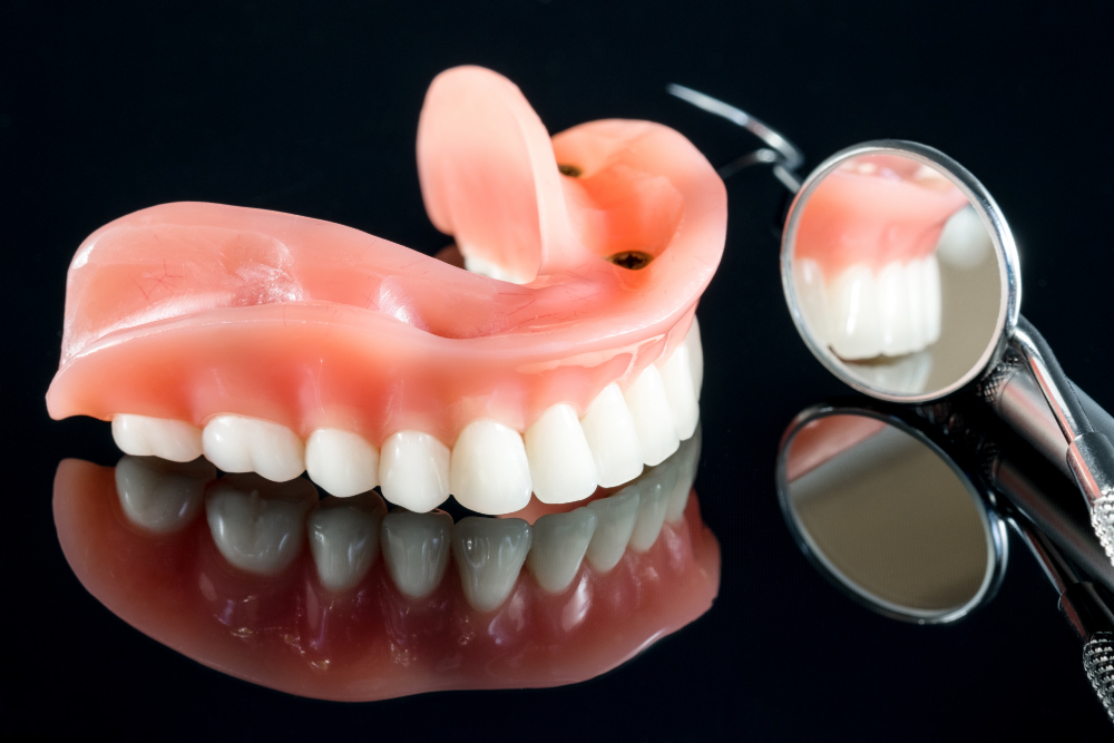 Виды протезирования при полном отсутствии верхних зубов