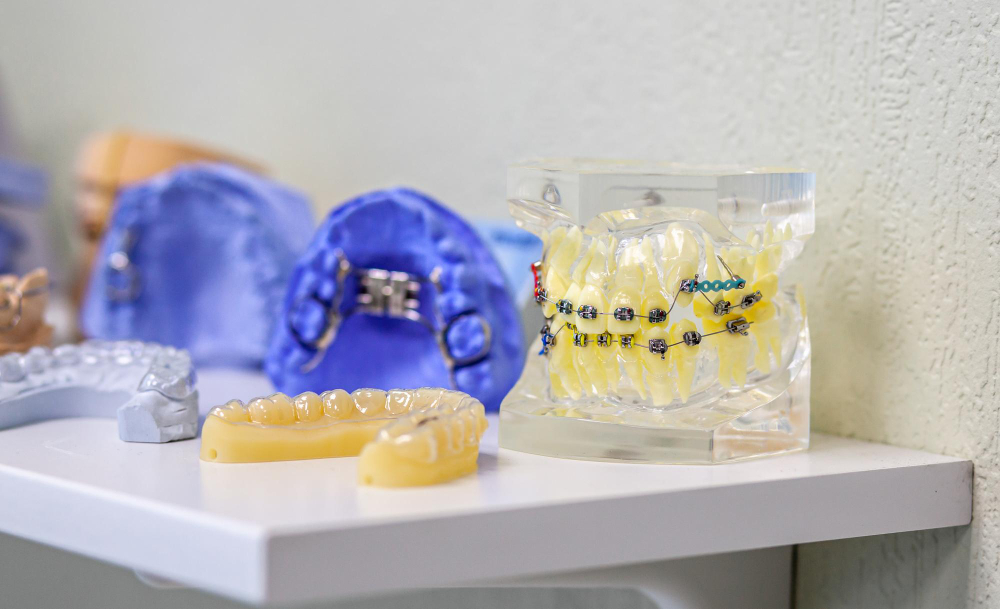 Чем занимается врач стоматолог-ортодонт