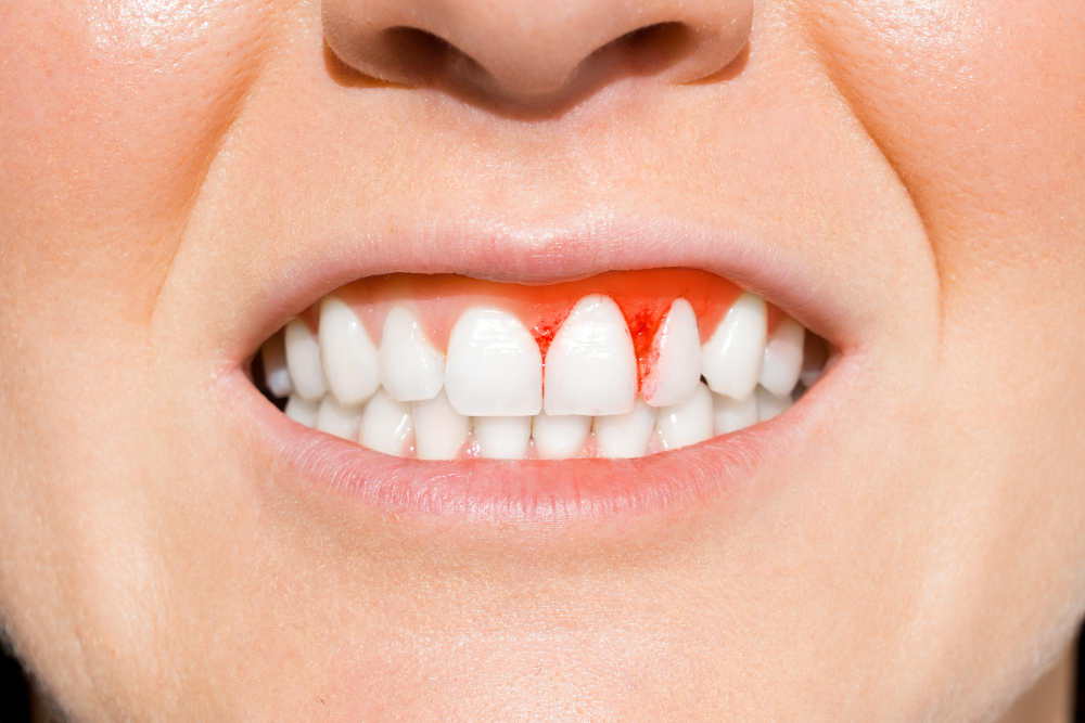 Почему сильно болит зуб или десна