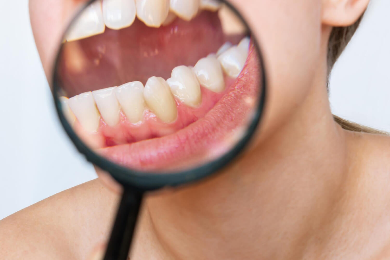 Зубной камень – что это такое, почему он опасен и как его убрать
