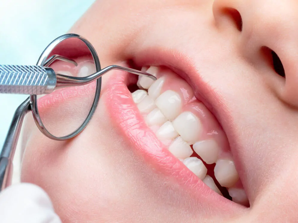 Лечение молочных зубов у детей 