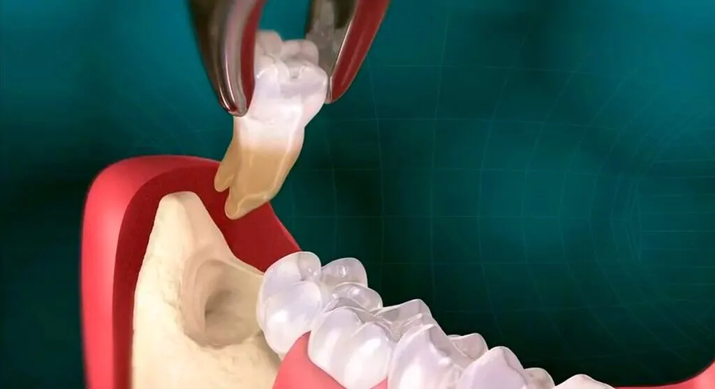 Стыдно идти к стоматологу: причины, последствия и как с этим справиться