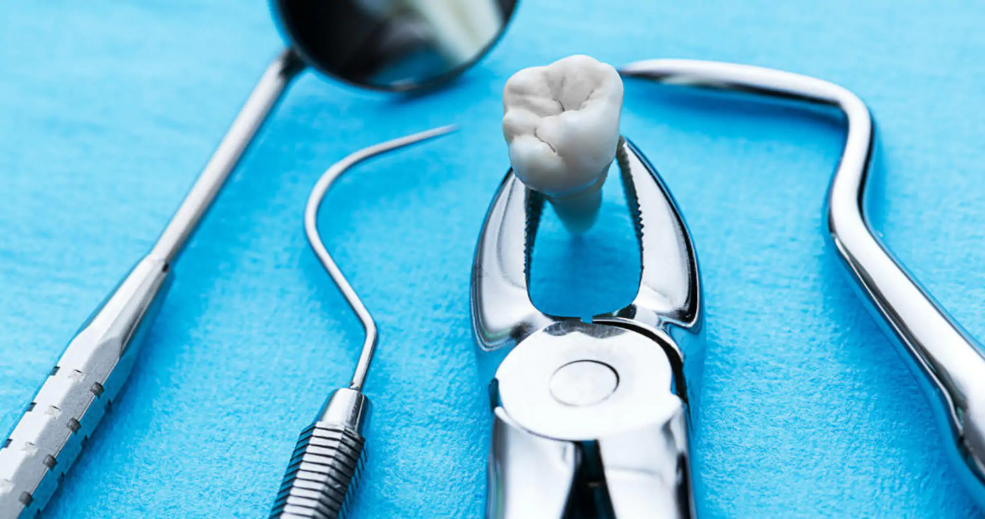 Удаление зуба мудрости – отзывы, которые будут полезными при восстановлении