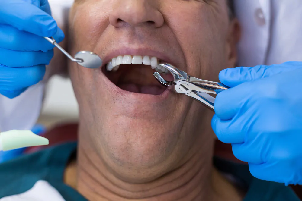 Особенности удаления подвижного фрагмента зуба